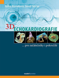 3D Echokardiografie - Kovalová Sylva