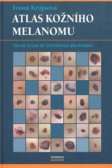 Atlas kožního melanomu - Krajsová Ivana