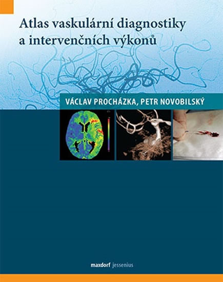 Atlas vaskulární diagnostiky a intervenčních výkonů - Procházka Václav