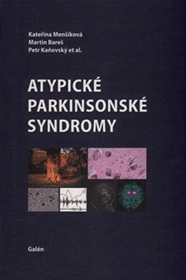 Atypické parkinsonské syndromy - Menšíková Kateřina