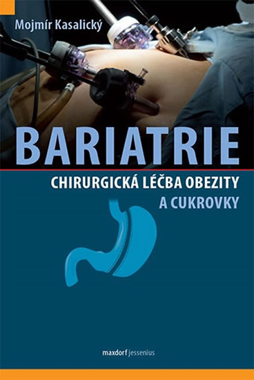 Bariatrie - Chirurgická léčba obezity a cukrovky - Kasalický Mojmír