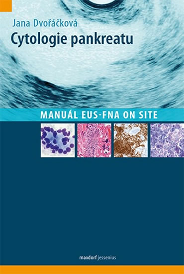Cytologie pankreatu - Manuál EUS-FNA on site - Dvořáčková Jana - 16