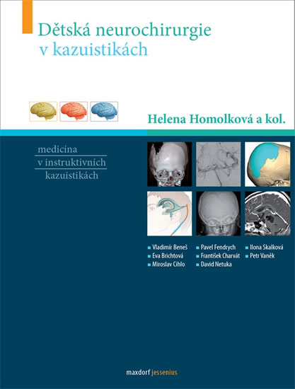 Dětská neurochirurgie v kazuistikách - Homolková Helena a kolektiv
