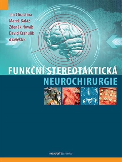 Funkční stereotaktická neurochirurgie - Chrastina Jan