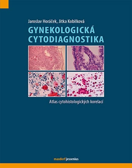 Gynekologická cytodiagnostika - Atlas cytohistologických korelací - Horáček Jaroslav