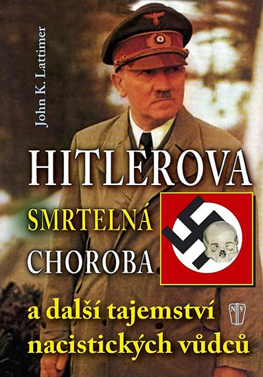 Hitlerova smrtelná choroba a další tajemství nacistických vůdců - Lattimer John K. - 16