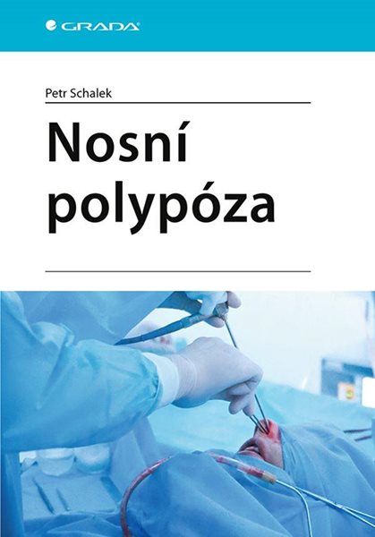 Nosní polypóza - Schalek Petr