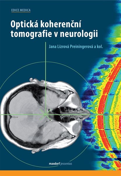 Optická koherenční tomografie v neurologii - Lízrová Preiningerová Jana