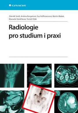 Radiologie pro studium i praxi - Seidl Zdeněk - 17x24